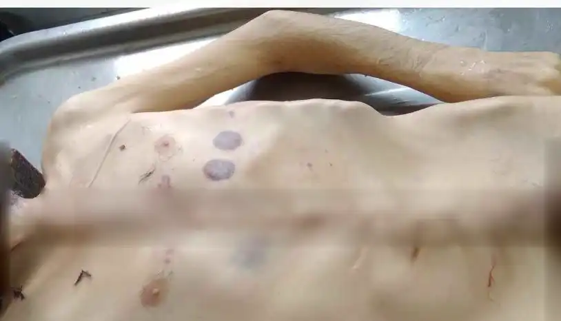  Արցախի մէջ. Սովամահութեան դէպք գրանցուած է 