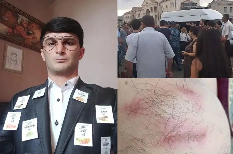 Արցախի մէջ.  Արայիկ Յարութիւնեանը նմանակող քաղաքացիին ոստիկանութենէն ներս ծեծի ենթարկած են (լուսանկար)