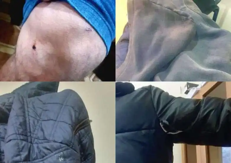 Արցախ. Գետաւան շրջանին մէջ ատրպէյճանցիներ բռնութիւն գործադրած են հայ երիտասարդներու նկատմամբ 