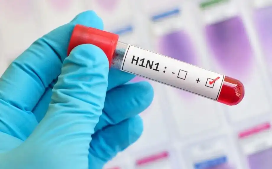 Հայաստանում խոզագրիպից (H1N1) 2 երիտասարդ է մահացել