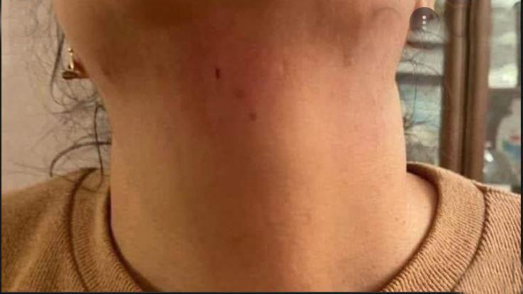 Պաքուի մէջ լրագրողի վրայ յարձակած են