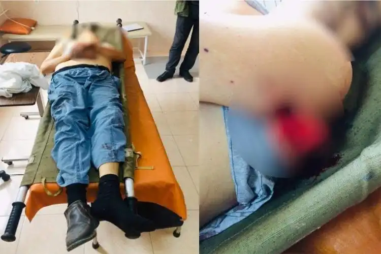  Արցախի մէջ  թշնամիի գնդակով  55-ամեայ քաղաքացի մը զոհուած է 