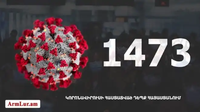 Հայաստանի մէջ «Քորոնա» Ժահրով վարակուած անձերու հաստատուած թիւը հասաւ 1473-ի