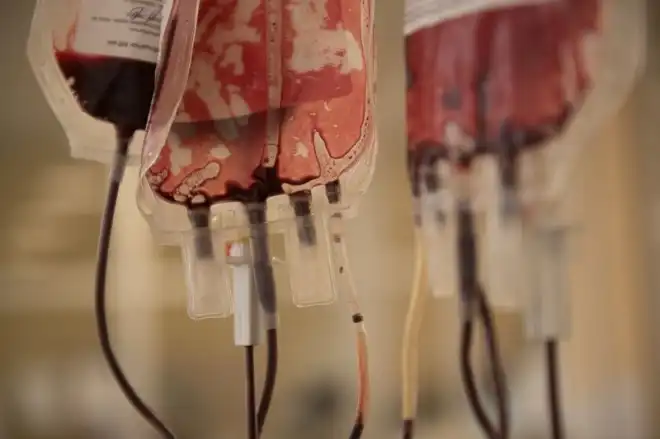 Հայաստանի մէջ  առաջին բացասական տեսակի արեան կարիք կայ