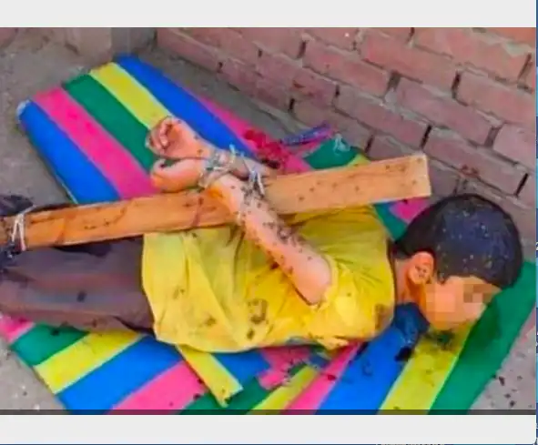 Արտառոց դէպք Եգիպտոսի մէջ. Զաւակը պատժելու համար հայրը սեւ մեղրով պատած է 6-ամայ երեխայի մարմինը